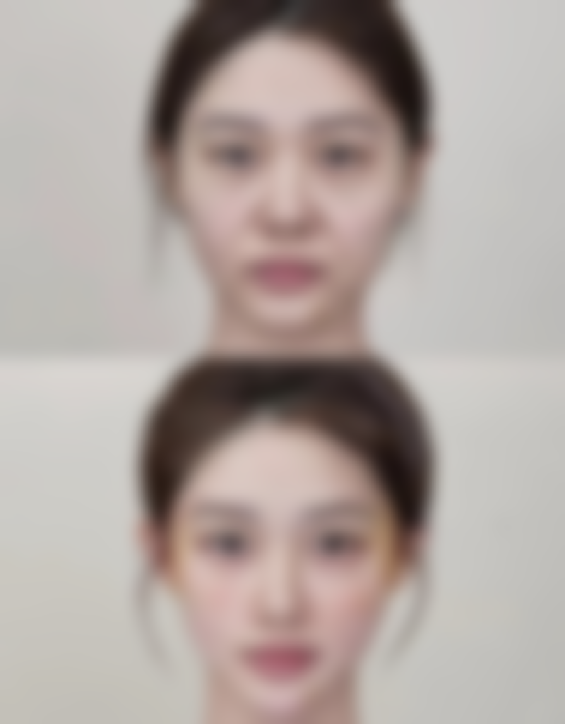 AGA皮肤科静冈2026年价格收费表：