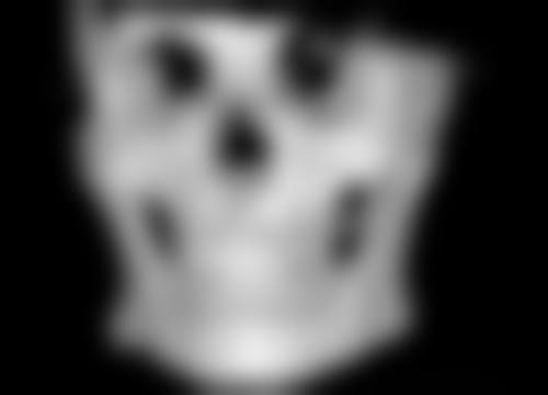 深圳广和门诊部李兴医生口碑评价与项目分享：