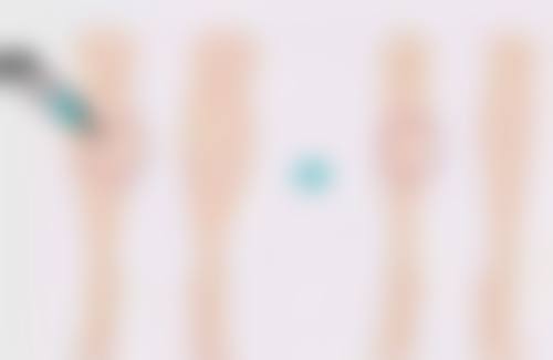 朱仪谨医生的技术实力