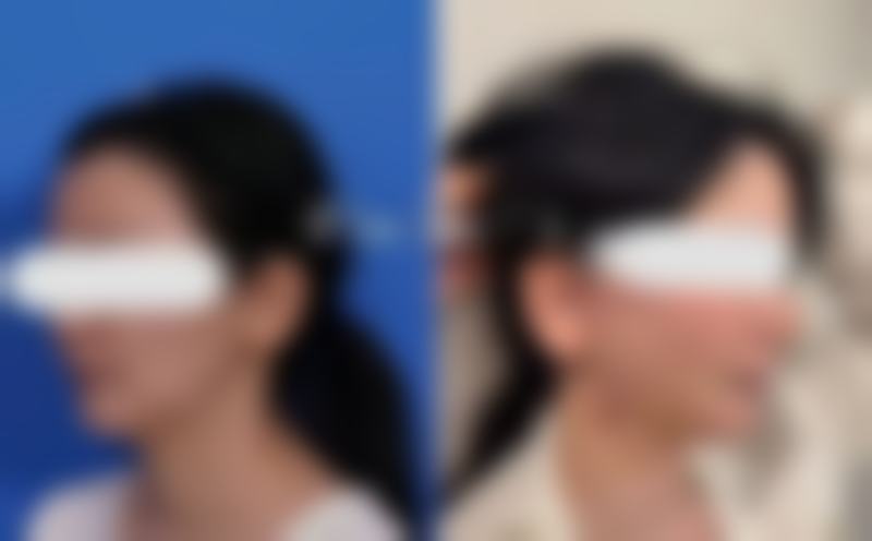 哈尔滨斯美偌整形医疗美容门诊疗疗反馈与口碑评价。