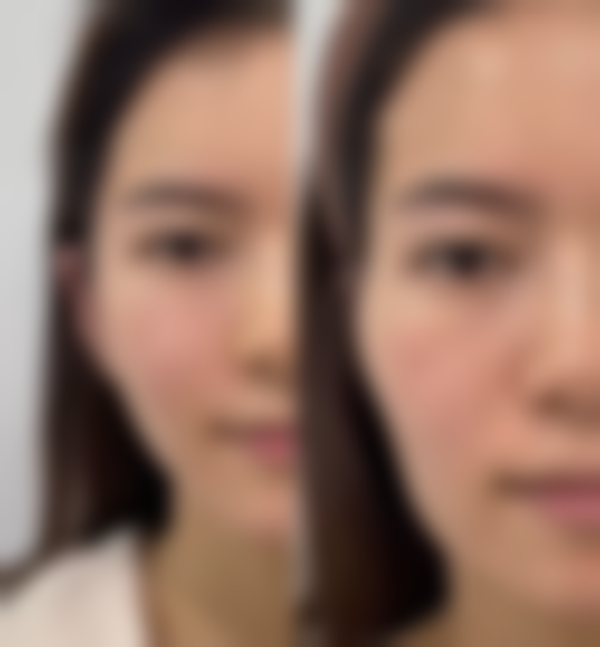 王兴亚擅长的治疗项目