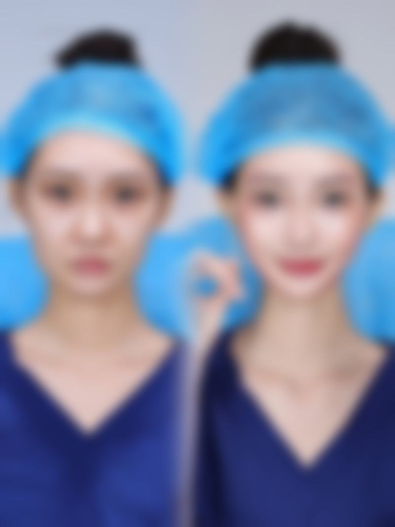 唐山美泉整形医疗美容诊所口碑评价与项目分享：