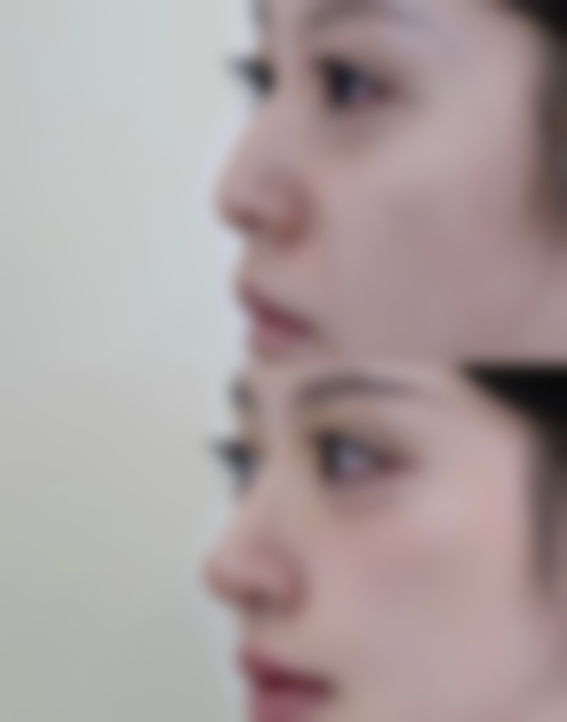 成都润美玉之光整形美容医院预约挂号方式。