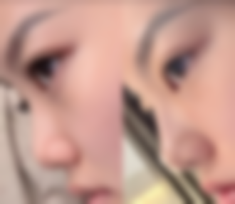 哈尔滨斯美偌整形医疗美容门诊医生团队经验稳定。