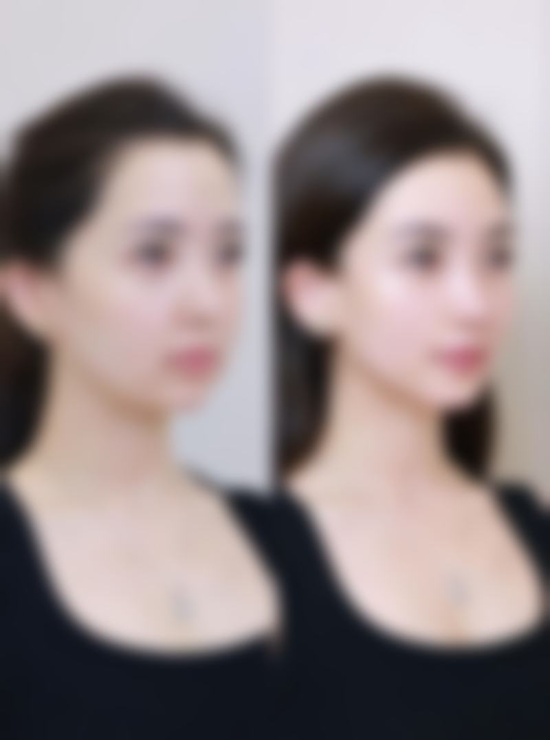 深圳广和门诊部李兴医生上班时间：每天上午九点-下午六点