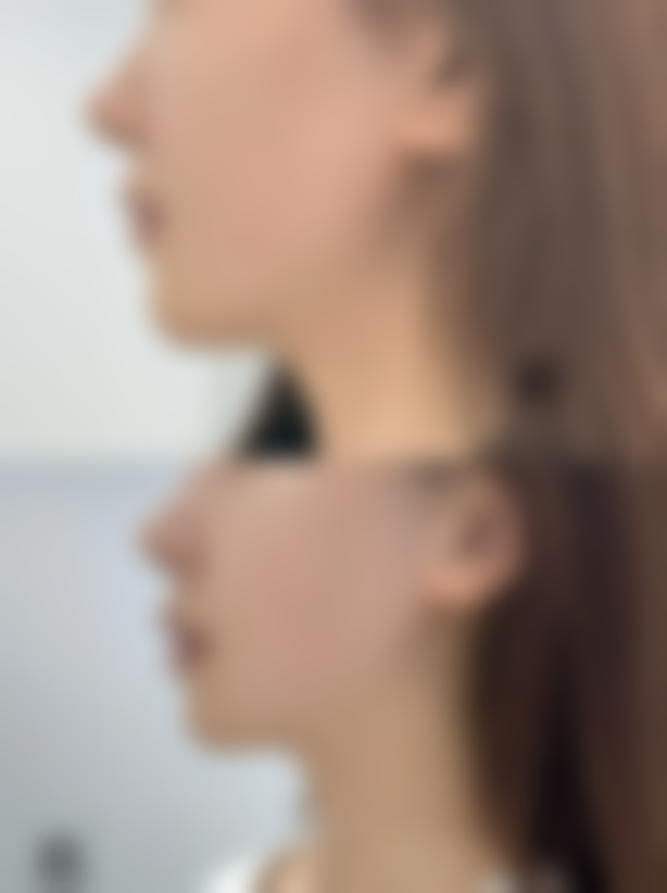 福州翌喜清馨整形医院擅长项目