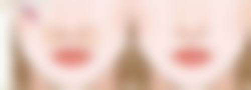 深圳同仁整形医疗美容医院姜昱瑾医生口碑评价与项目分享：