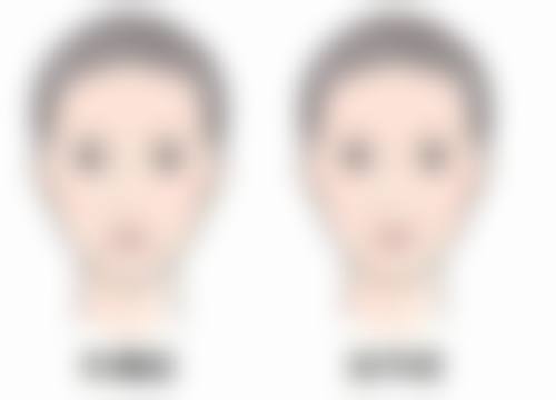 山东中医 大学中鲁医院激光整形美容中 心地理位置便于到院。