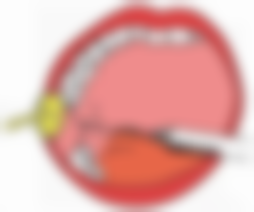  长沙荪臻臻整形医院李迎军 医生技术怎么样