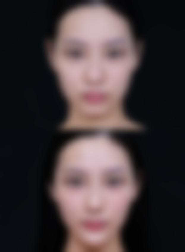 陈学善医生擅长的项目