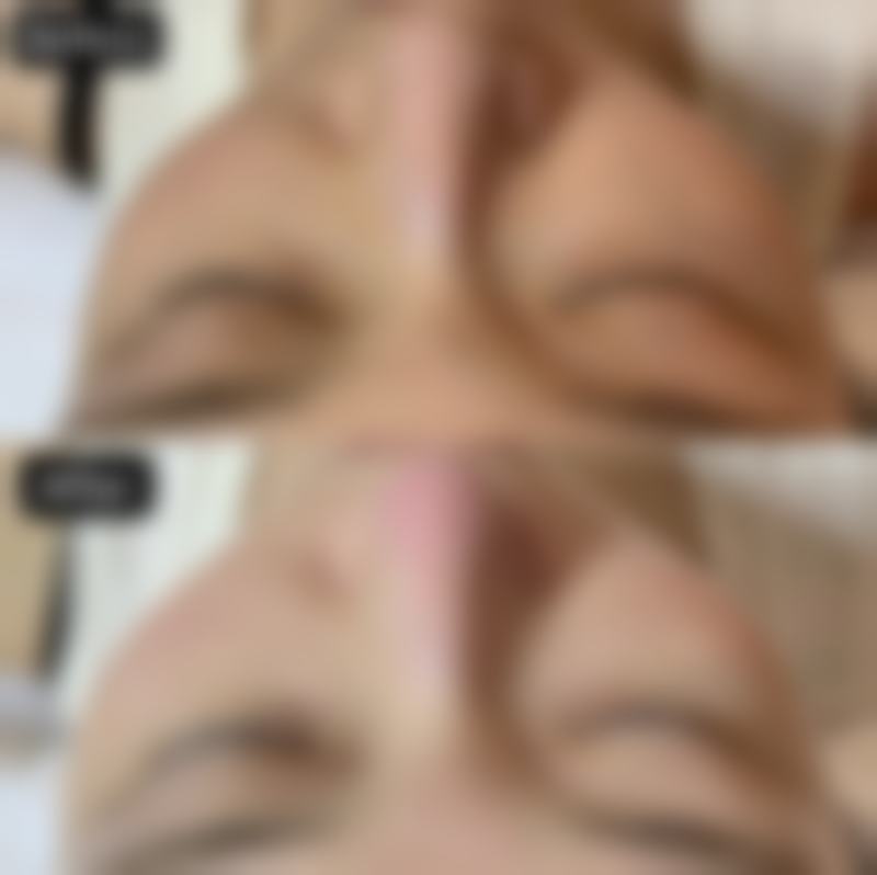 陈学善医生的技术实力