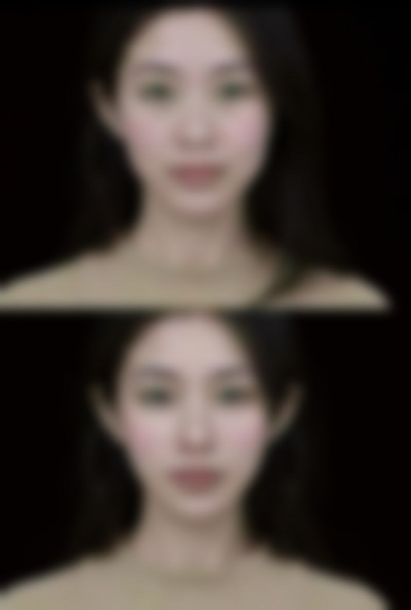 金亨烈医生擅长的项目