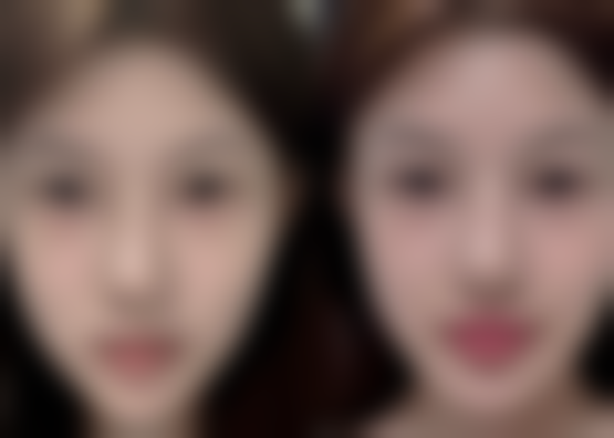 厦门大学附属中山医院整形美容科口碑评价