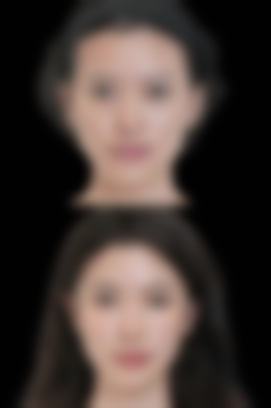 长沙荪臻臻整形医院李迎军 医生价格收费表查询