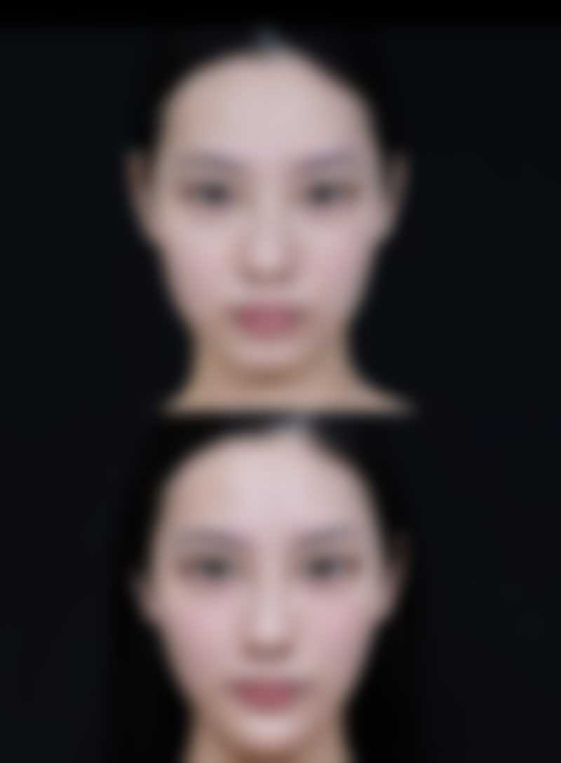 合肥台美丽格医疗美容的擅长项目