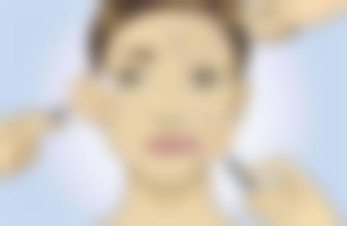 武汉小忠丽格协同医疗美容门诊部医生团队经验稳定。