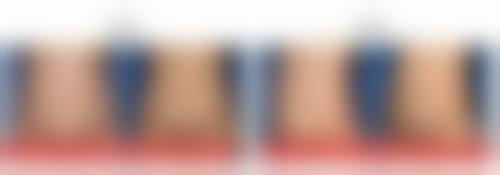 吕福华医生技术实力