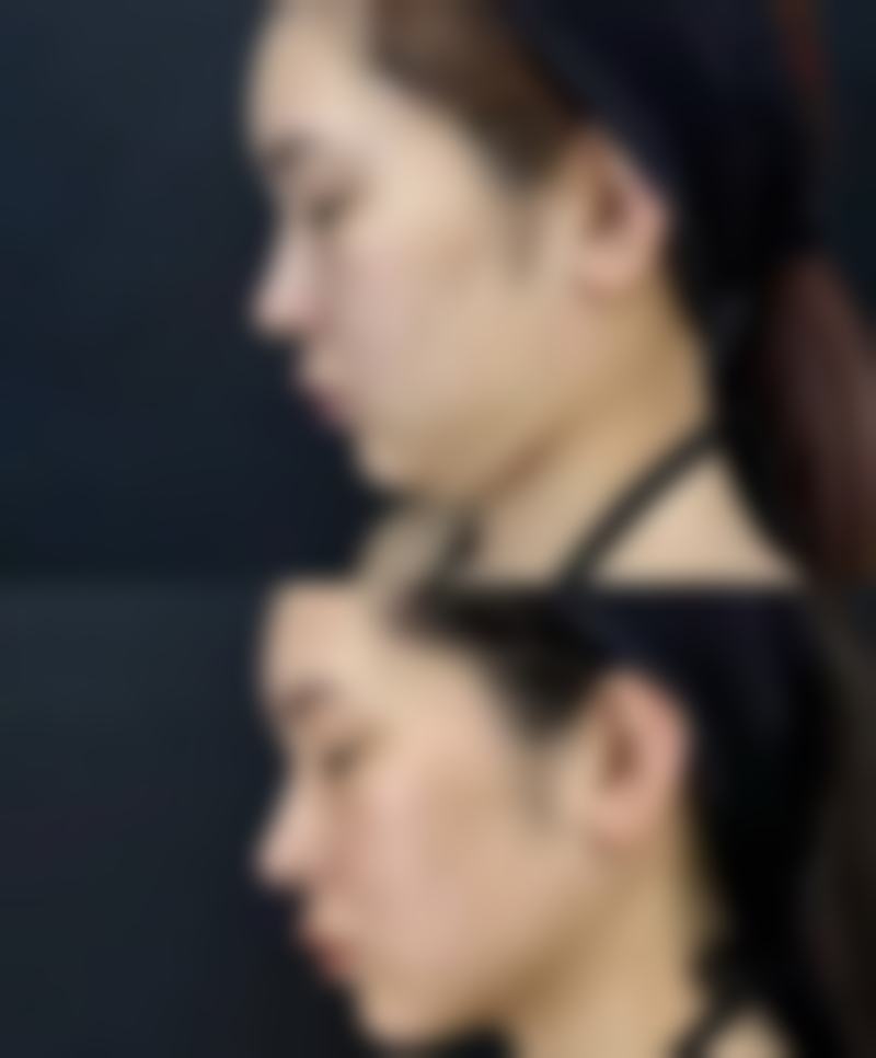 武汉小忠丽格协同医疗美容门诊部治疗反馈与口碑评价。