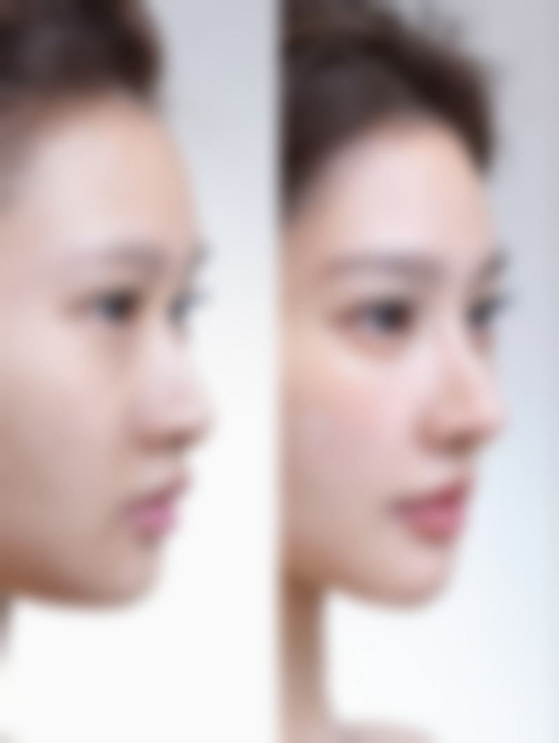 金荣振医生擅长的项目