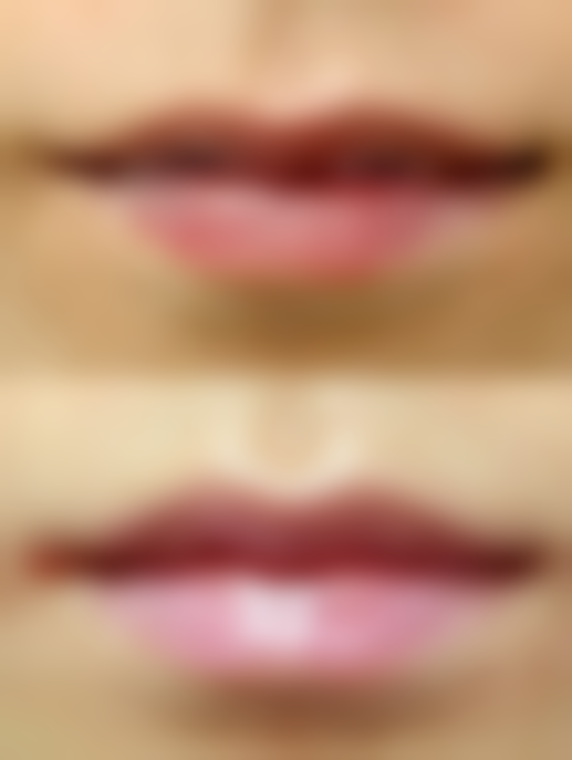 金淍湖院长技术实力展现