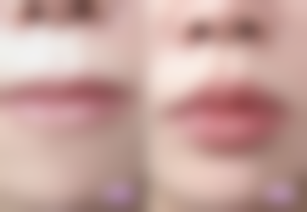 韩国PT（pretty）整形外科简介