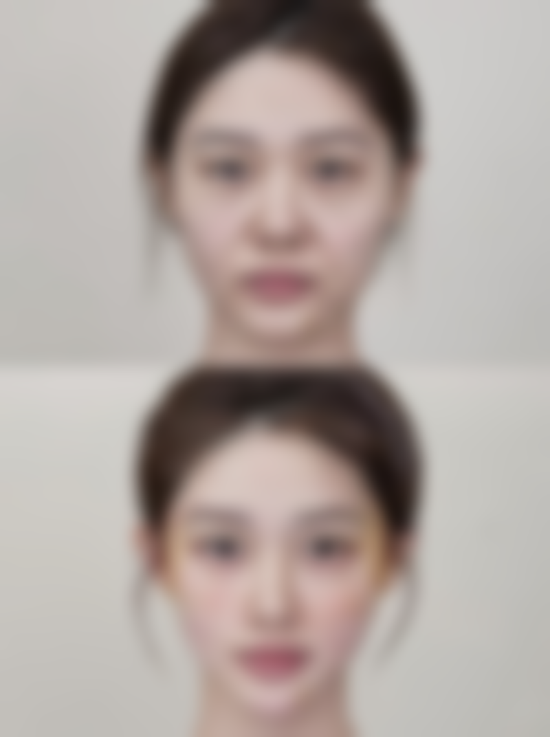 大连臻熙医疗美容门诊部治疗反馈与口碑评价。