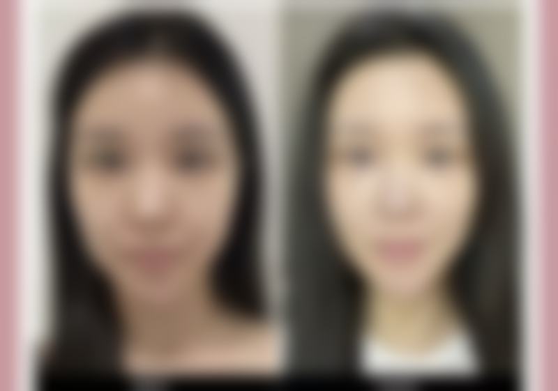 北京悦美好医医疗美容医院门诊营业时间。