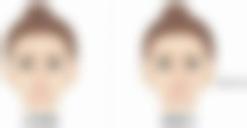 北京德尔美客美熙医疗美容诊所擅长项目。