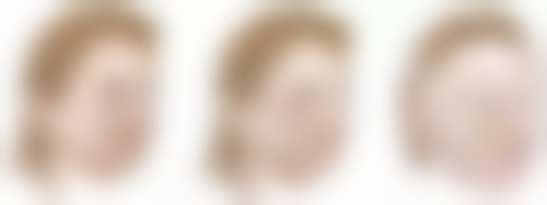 台州妍度医疗美容门诊部收费价格表