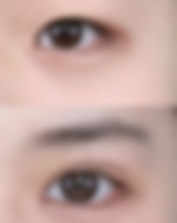 郑州喜美医疗美容门诊部擅长项目