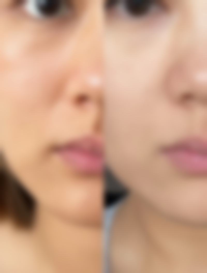 湖北襄阳合美医疗美容治疗反馈与口碑评价。