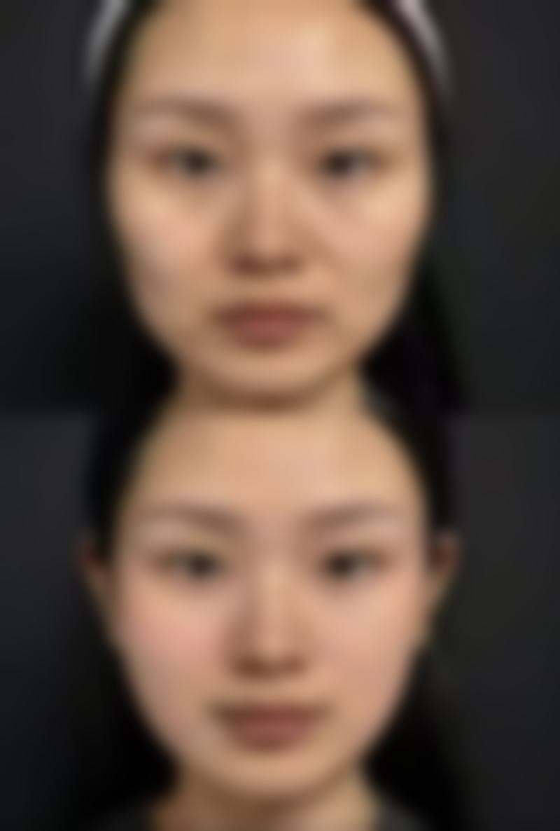 深圳可丽雅医疗美容门诊部洪星杓医生技术怎么样