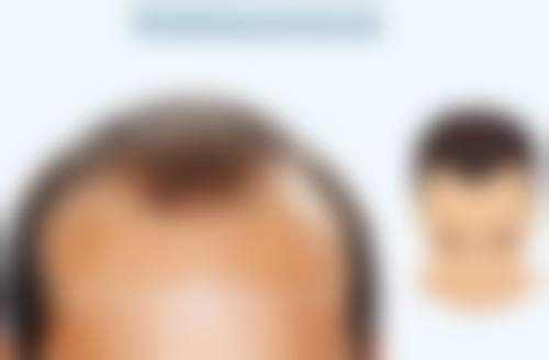 本溪三一三医院烧伤整形科医生团队经验稳定。