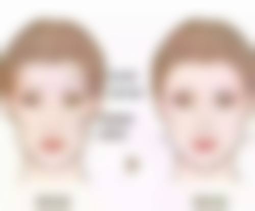 长沙荪臻臻整形医院擅长的项目