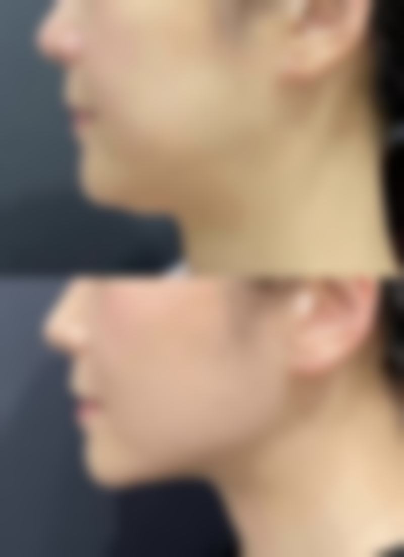 长沙荪臻臻整形医院的口碑评价