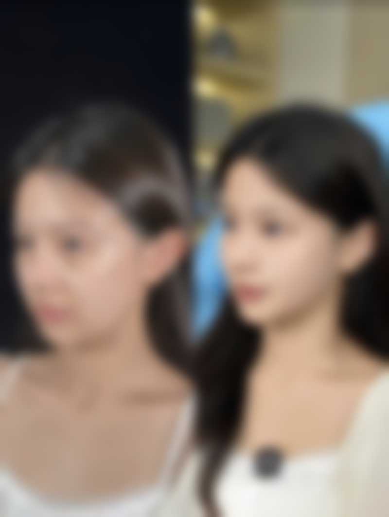 广州市第十二人民医院陈家欢医生技术怎么样