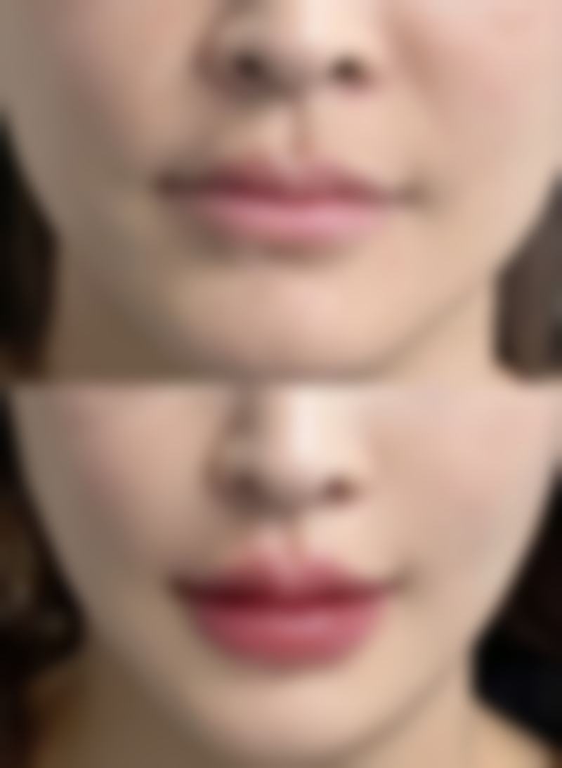 唐山遵化整形医疗美容医院医生团队经验稳定。