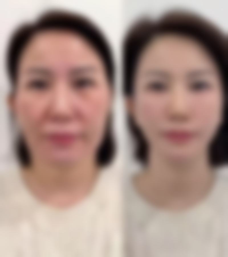 西安碧莲盛植发诊所上班时间