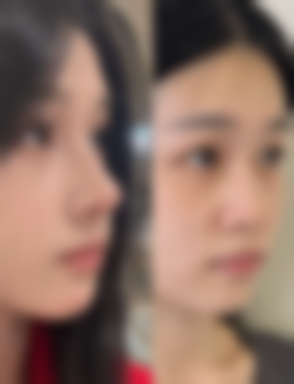 本溪三一三医院烧伤整形科擅长项目。