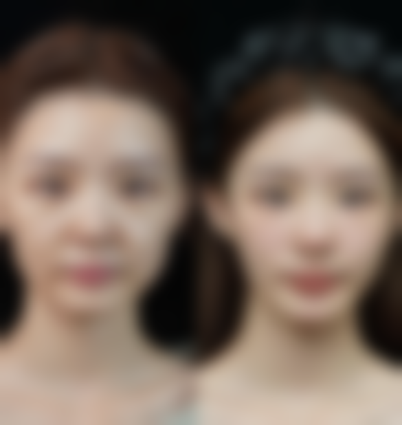 兰州美示整形美容诊所口碑评价与项目分享: