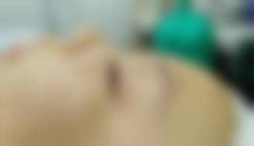 成都达芬奇整形医疗美容医院治疗反馈与口碑评价。