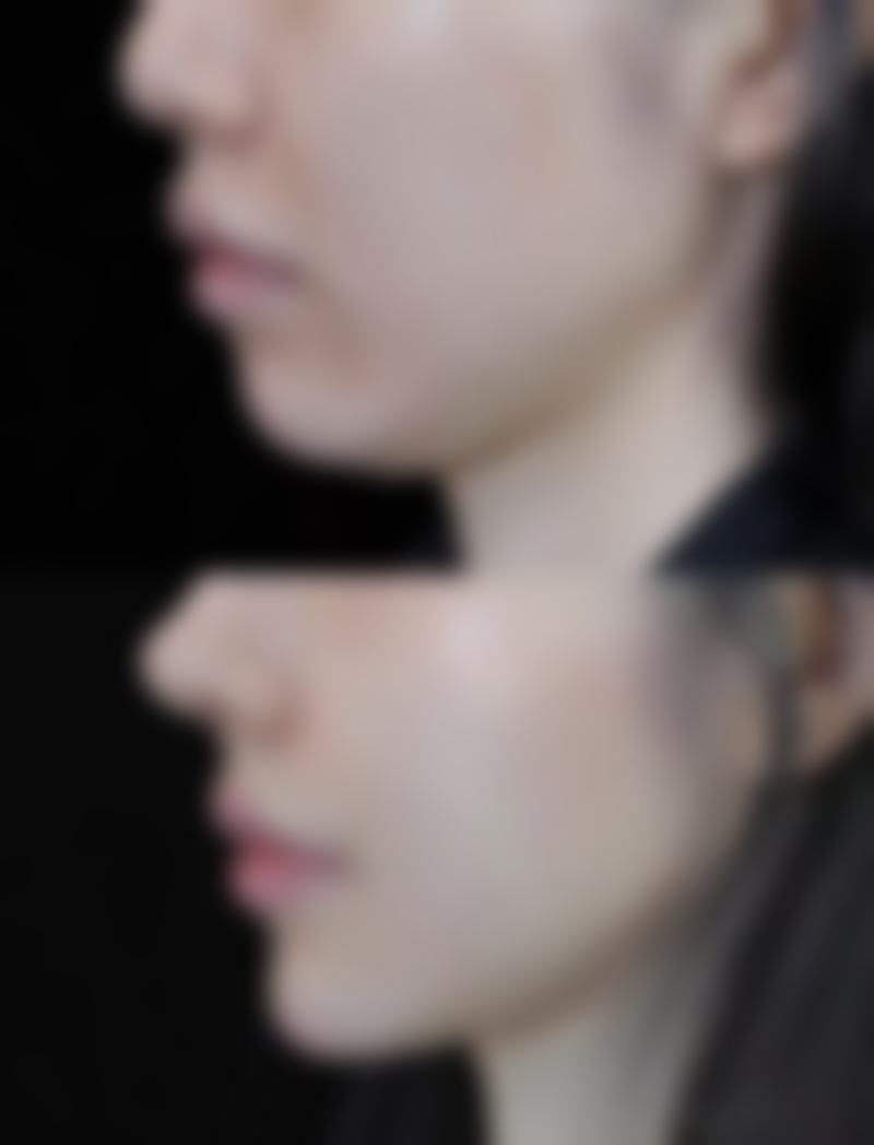 厦门思明海峡整形医疗美容医院医生团队经验稳定。