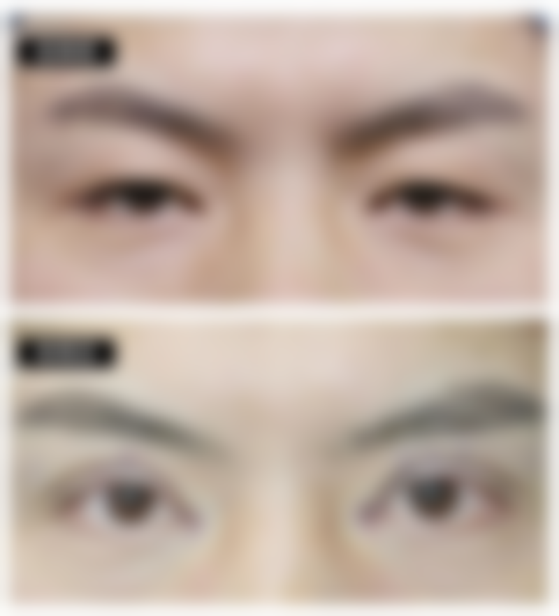 商丘时光医疗整形美容医院治疗反馈与口碑评价。