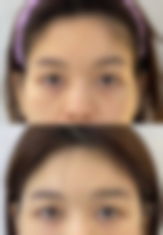 深圳天丽整形医院擅长项目