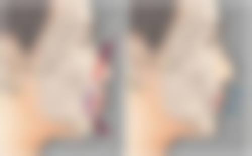 锡林浩特泽颜整形医院治疗反馈与口碑评价。