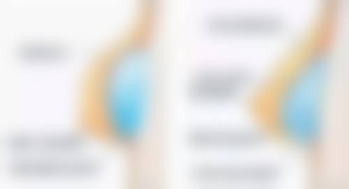 常熟圣莎拉医疗美容门诊部治疗反馈与口碑评价。