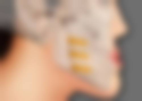 昆山陈医生整形医疗美容诊所医生团队经验稳定。