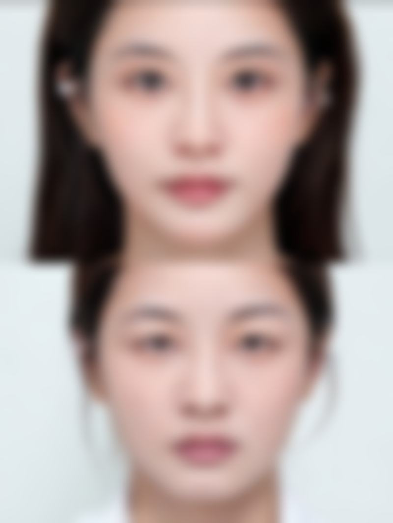 崔午圭医生擅长项目