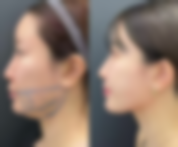 郑州智美好医生医疗美容诊所治疗反馈与口碑评价。