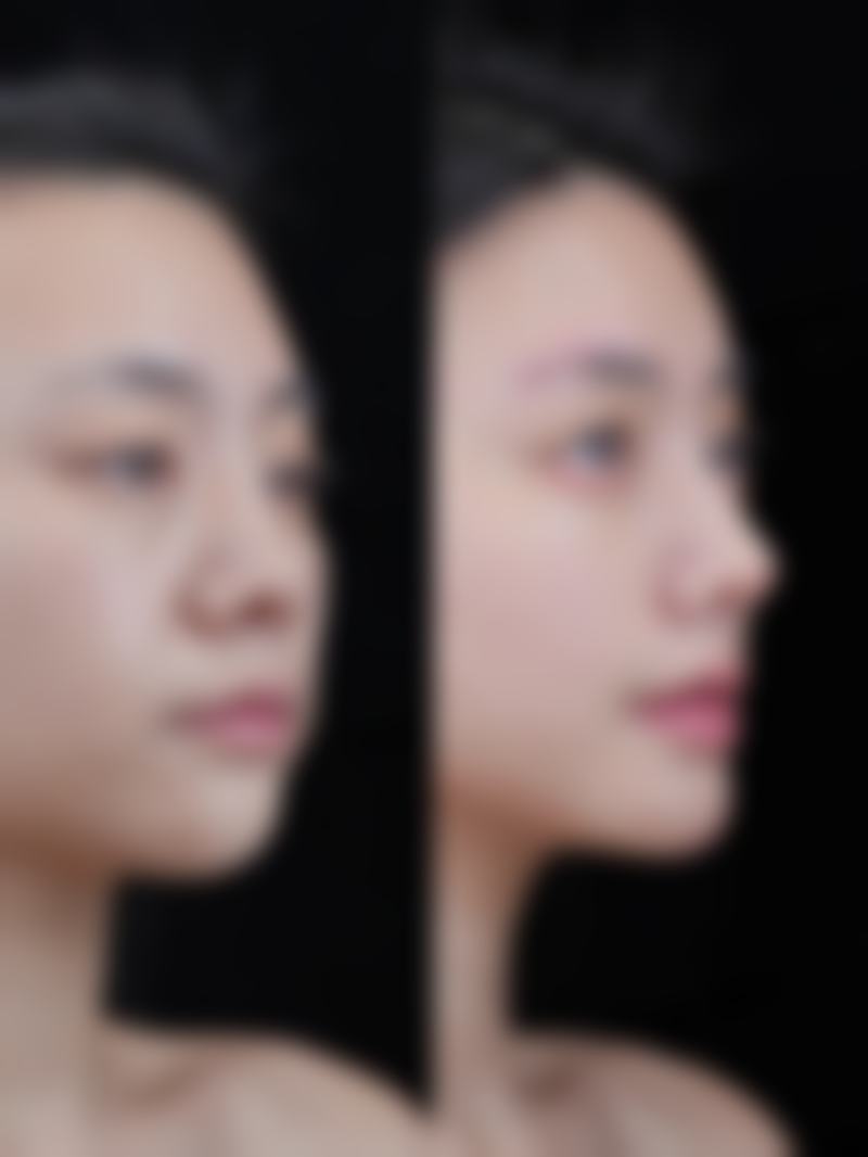 常熟圣莎拉医疗美容门诊部医生团队经验稳定。